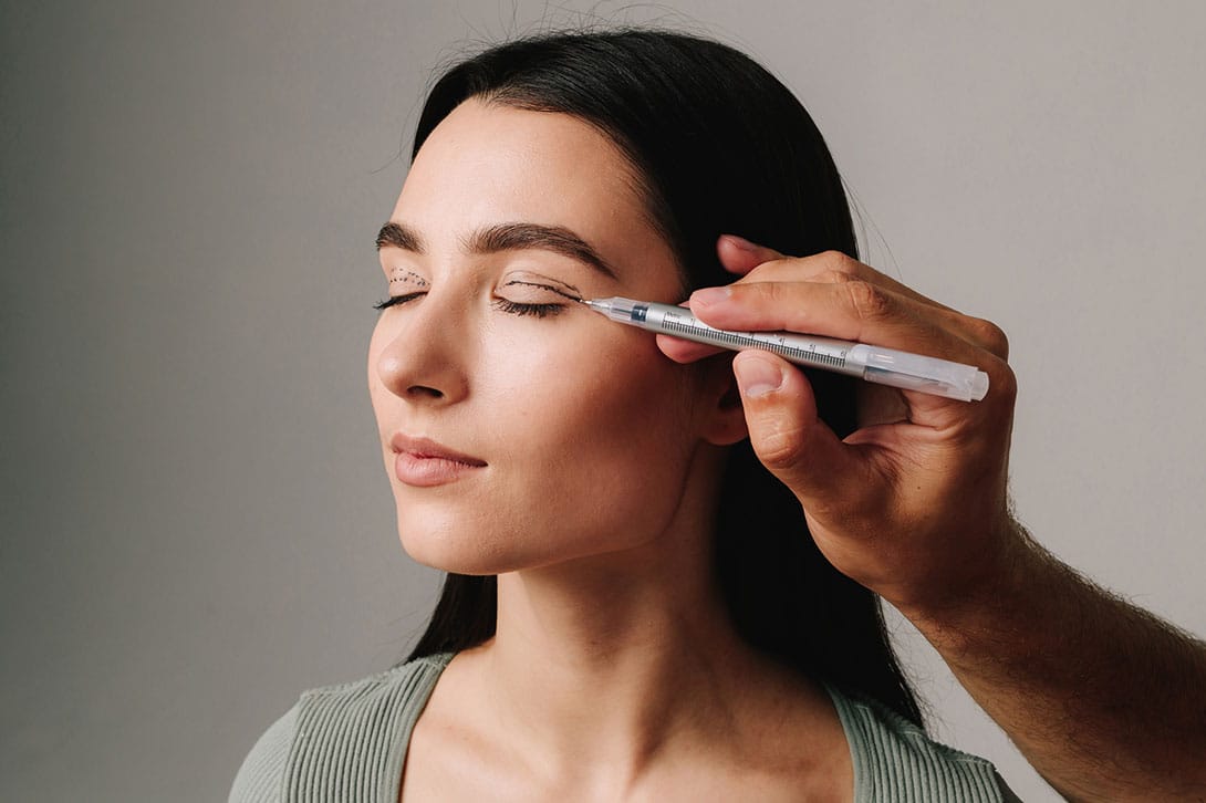patient before her blepharoplasty in Gulf Shores