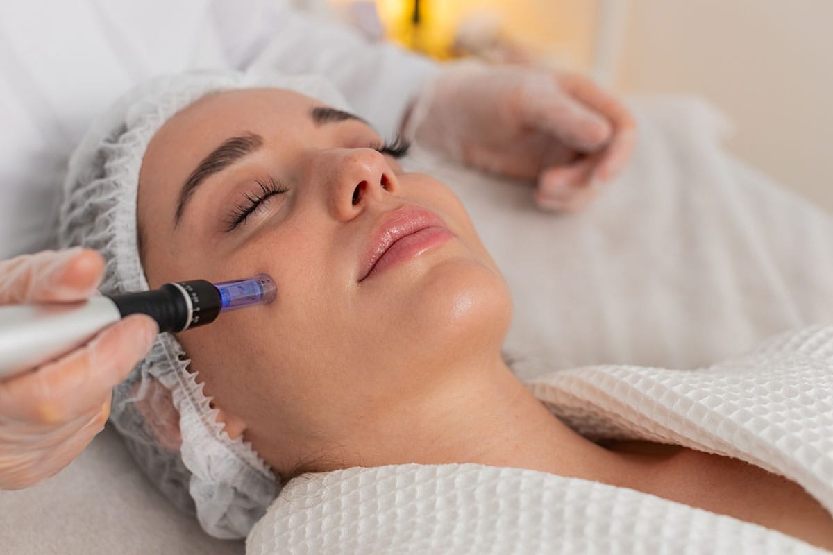 woman getting microneedling treatment in Gulf Shores, AL
