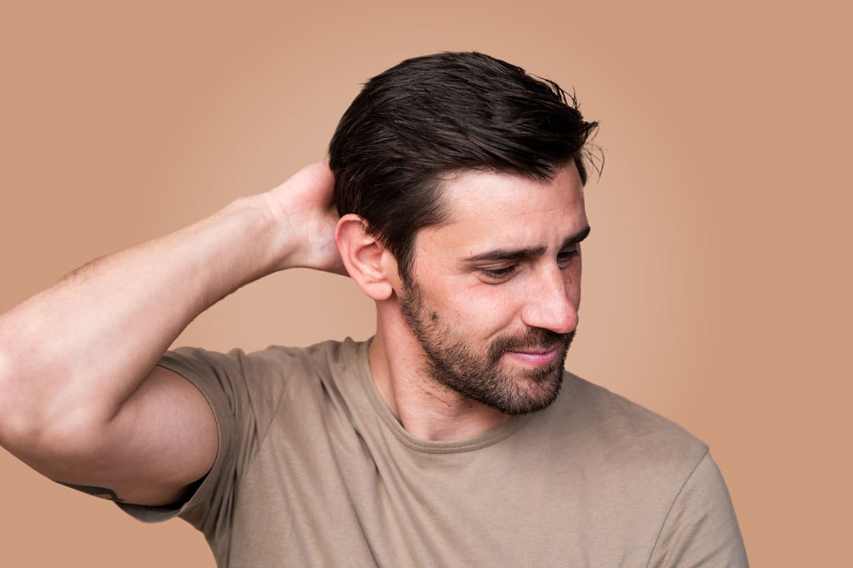 man after getting a hair transplant in Gulf Shores, AL